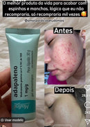 Gel Adapaleno Medley Para Tratamento de Acne