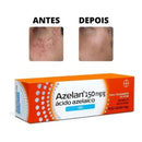 Azelan Ácido Azelaico Gel Tratamento Espinha Acne 30g