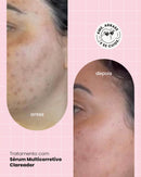 kit Serum Clareador Hidrabene com Protetor solar Facial clareador anasol